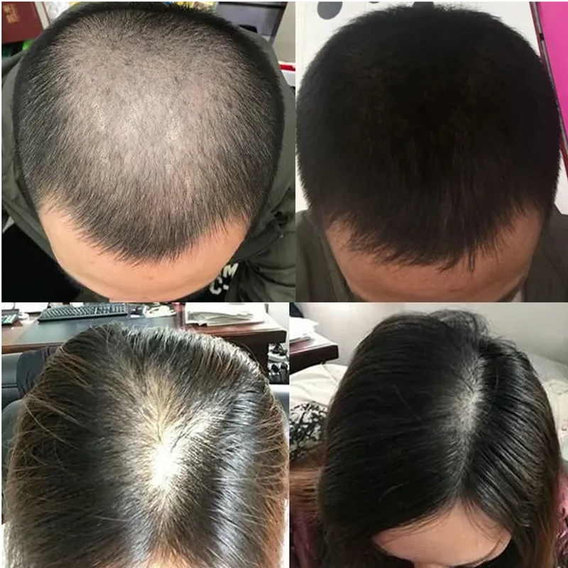 Liquide de croissance capillai - Hair Care Or Haircare avis et prix
