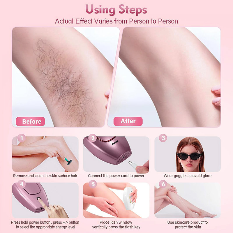 Épilateur laser IPL Machine de - Hair Care Or Haircare avis et prix